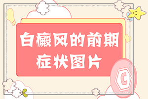 身上有白块是什么,诊断依据(发病的时候有什么症状)