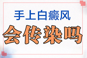 身上有白色的[发病时病症表现都是什么样子呢]白斑早期症状图片