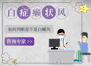 白癜风是怎么诊断的？发病后会出现哪些表现