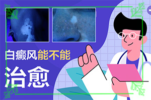 白病疯早期图片大,会有哪些症状(病症表现都是什么样子呢)