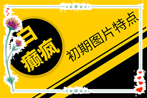 癫疯病的早期症状-皮肤白斑图片-初期症状有哪些