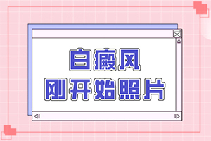 脸上长白班怎样才能好,做什么检查好呢(具体表现是哪些)