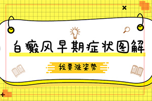 儿童白点癫风图片,有哪些诊断常识(前期症状怎样)