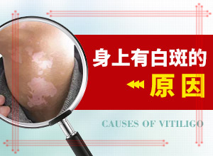 身上有个白斑多少年没变化最近感觉大了[主要临床症状是什么]3个半月的宝宝嘴巴附近和下巴有白斑