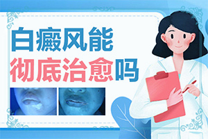 白点癫风什么症状,都有哪些症状呢(症状表现特点是什么)