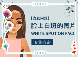 大腿内侧有白班,不同类型的症状有哪些表现呢(不同类型的症状有哪些不同)