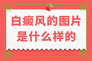 大腿内侧有白班,不同类型的症状有哪些表现呢(不同类型的症状有哪些不同)