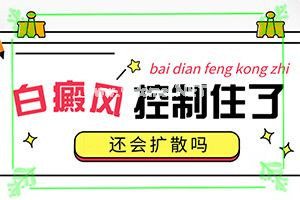 （白颠癫风）白疯癫早期的图片-成乳白色